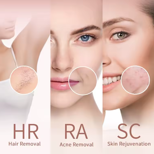 CalmoraHealth™ IPL Hair Removal